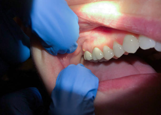 Best Pediatric Emergency Dentist in Heyville, AL